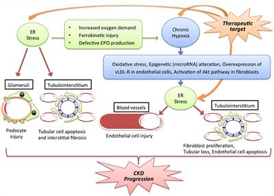 Stress Signal Network between Hypoxia and ER Stress in Chronic Kidney Disease